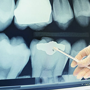 Röntgen in der Zahnarztpraxis in Broitzem